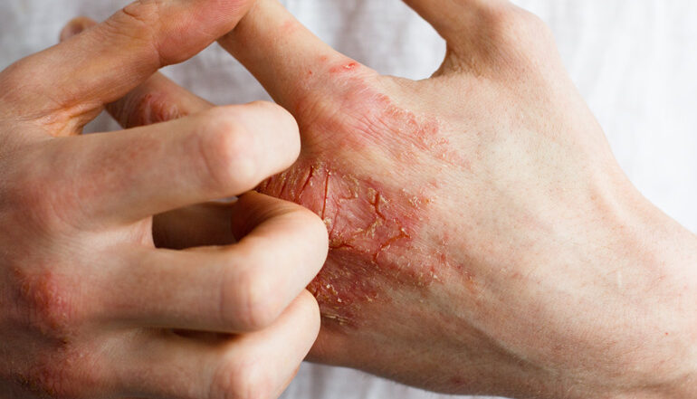 Skin Diseases-big